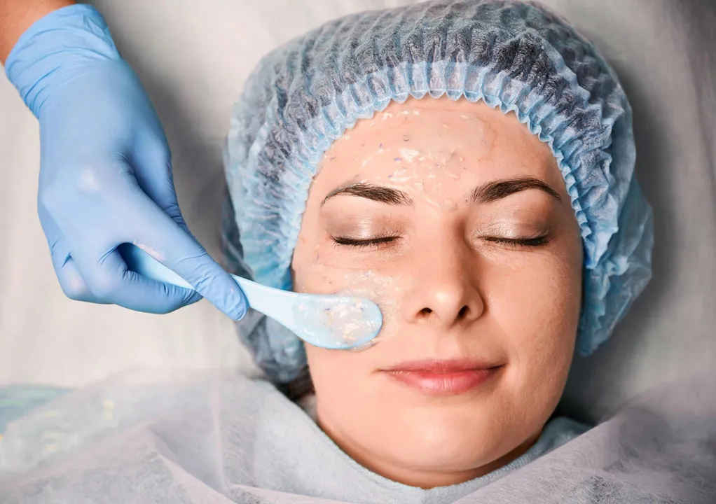 Kimyasal Peeling Nedir, Çeşitleri Nelerdir?